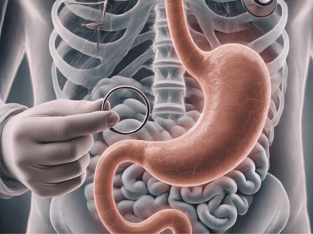 Illustration médicale représentant un estomac avec un anneau gastrique virtuel, utilisée pour illustrer l’article sur l’hypnose et la gestion du poids
